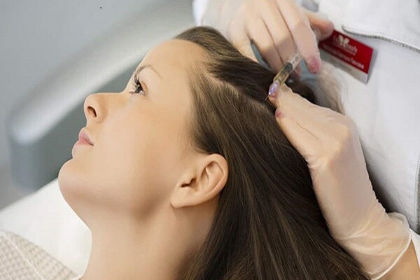 PRP برای درمان ریزش مو